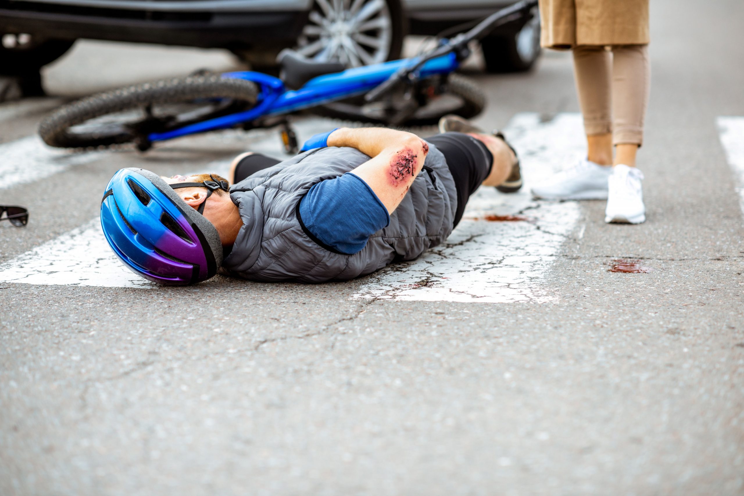 La Guía Esencial para Ciclistas: Cómo un Abogado de Lesiones Personales Puede Ayudarte Después de un Accidente